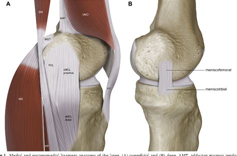 Figure 1 from Surgical Repair of Medial Collateral Ligament and Posteromedial Corner Injuries of ...