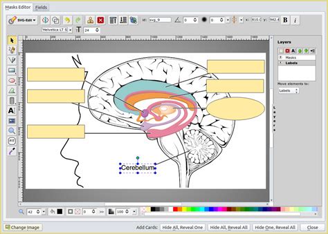 Alternatives and detailed information of Image Occlusion Enhanced ...