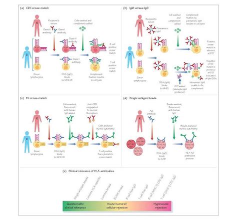 Detecting HLA Antibodies In addition to identifying the HLA antigens ...