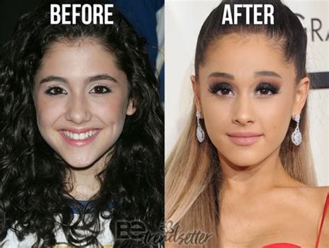 Ariana Grande Plastic Surgery REVEALED! Then And Now