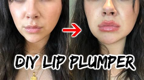 Diy Lip Filler Gone Wrong - Plastic Surgery Fails: 8 Lip Enhancements Gone Wrong - Oddee ...