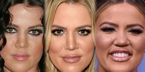 Khloé Kardashian Face Filler Transformation - BuzzPopDaily