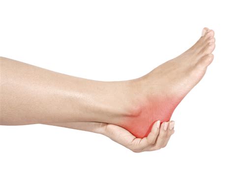 What is Causing My Heel Pain? | NeuroSpine Surgical Consultants