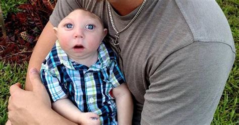 Baby born missing most of his brain celebrates milestones - CBS News