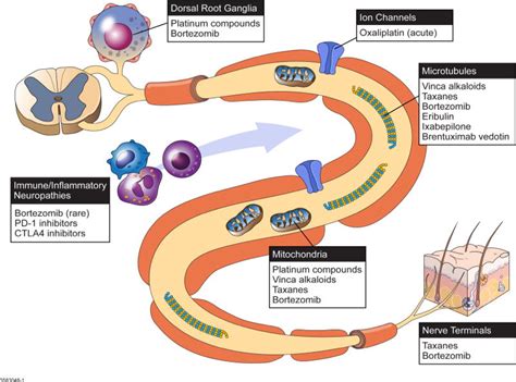 Chemotherapy-Induced Peripheral Neuropathy (CIPN)