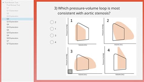 Pressure Volume Loop | E-Gallery | University of Nebraska Medical Center