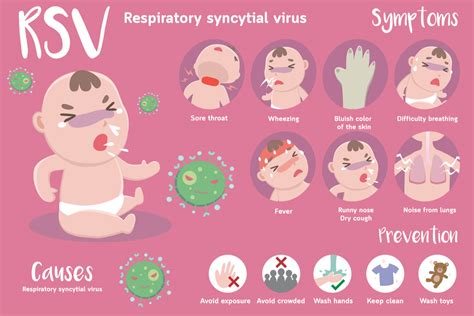 Bronchiolitis in Babies - Causes, Signs, and Treatments by Dr. Srikanta J T - Being The Parent