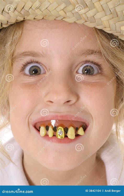 Rotten Teeth. Royalty-Free Stock Image | CartoonDealer.com #35981548