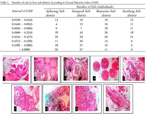 Micrograph / Histology of Gonad Development (Gonadogenesis) of Female ...