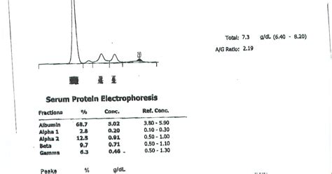 jm's Adventure with Multiple Myeloma: SPEP - M-Spike Values from ...