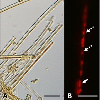 (PDF) Autolysis of Bacterial Cells Leads to Formation of Empty Sheaths by Leptothrix spp.