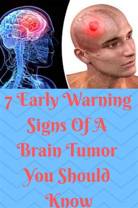 Signs And Symptoms Of A Brain Tumor