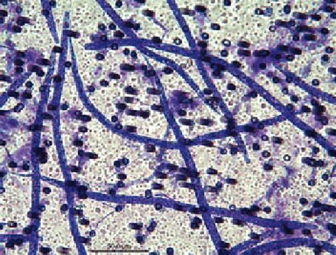 Heartworm Microfilaria