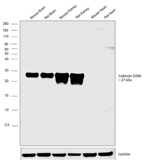 Calbindin D28K Antibody (PA5-46936)