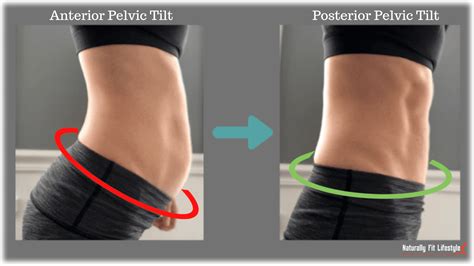 Lateral Pelvic Tilt Correction