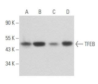 TFEB Antibody (17) | SCBT - Santa Cruz Biotechnology