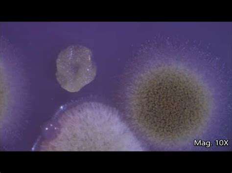 Petri Dish under the Microscope - YouTube