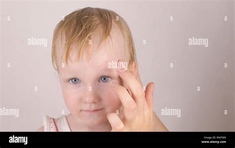 Forehead scar hi-res stock photography and images - Alamy