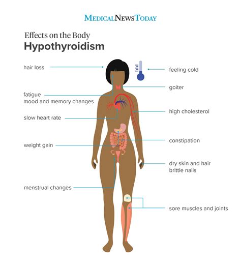 How To Spot Thyroid Problems - Resolutionrecognition4