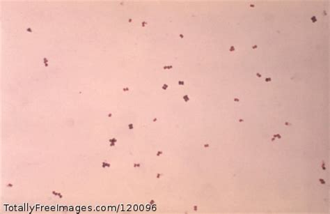 Peptococcus