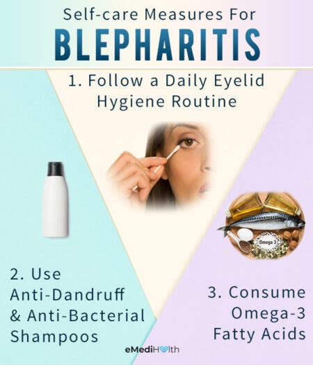 Blepharitis: Home Remedies & Self-Care Measures