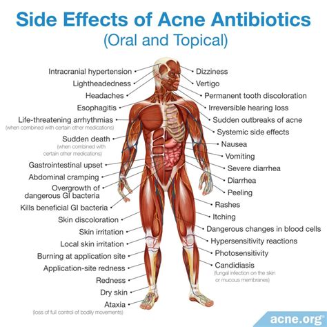 Antibiotic Resistance in Acne Treatment - Acne.org