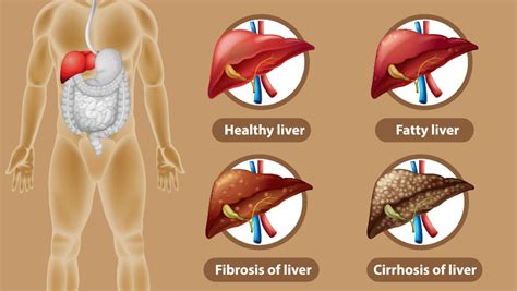 Liver treatment specialist in Chennai - Dr. Srivatsan Gurumurthy