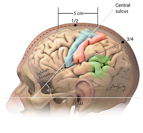 Scalp Incisions | The Neurosurgical Atlas