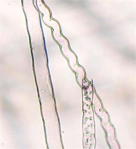 What are rhizoids? Function, structure, morphology