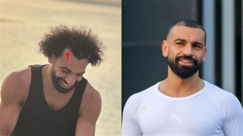 Mo Salah Hairline: Rejuvenating Transformation - SULE HAIR TRANSPLANT