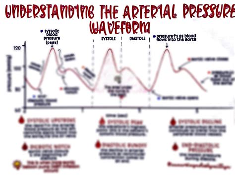 The Arterial Line ABP Waveform - Etsy Canada