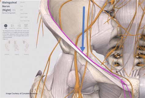 Iliohypogastric Nerve Pain