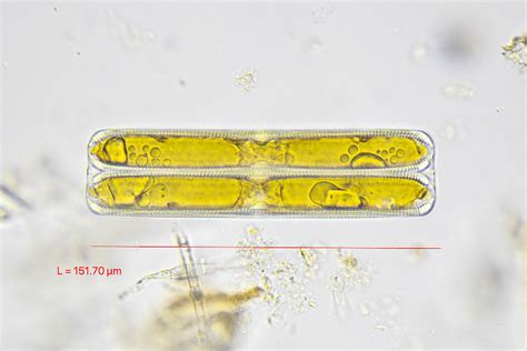 Pinnularia | The Microscopic Life of Shetland Lochs