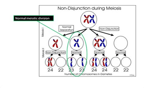 Down Syndrome Chromosomes