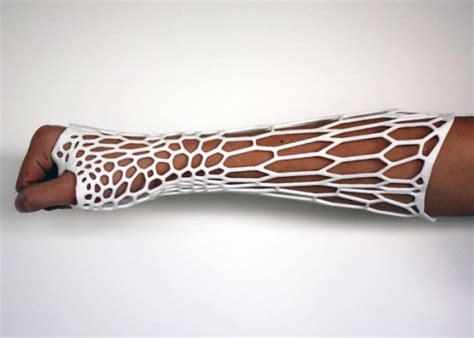 30 Creative Cast Designs That Prove You Can Still Look Cool With An Injury