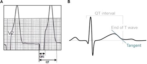 Hypermagnesemia Ecg Changes