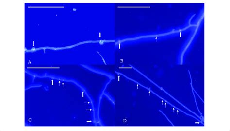 | Nuclear phenotype of DAPI-stained L. edodes heterokaryotic hyphae on ...