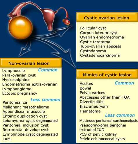 solid mass on ovary - Captions Rotation