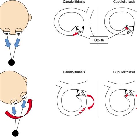 Schematic diagram of the influence of an otolith on the... | Download Scientific Diagram