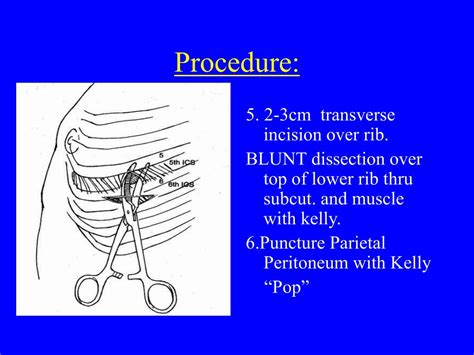 Chest Tube Insertion Procedure : Pin on About the lungs & heart ...