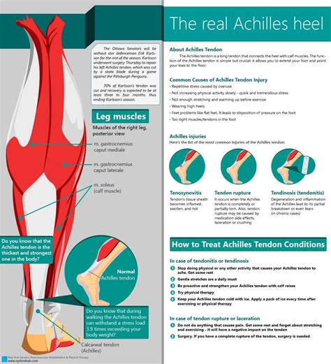 Achilles Tendon and treatment of Achilles Tendon rupture