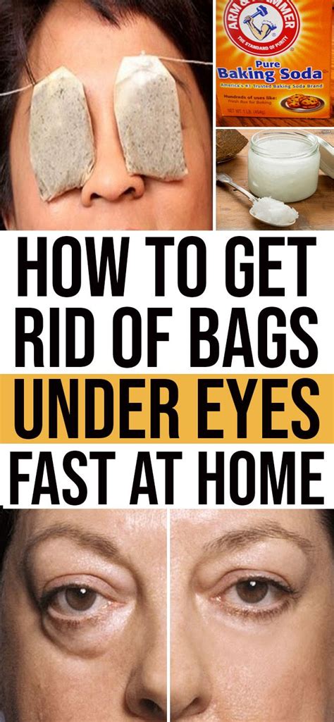 How To Get Rid Of Bags Under Eyes Fast With Home Remedies | Eye bags ...