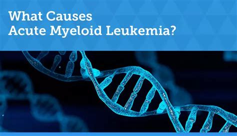 What Causes Acute Myeloid Leukemia? | MyLeukemiaTeam