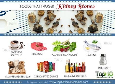 10 Foods that Trigger Kidney Stones | Top 10 Home Remedies