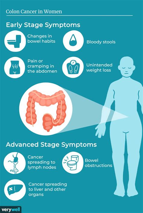 Colon Cancer in Women: Signs, Symptoms, and Complications