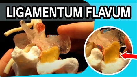 Ligamentum Flavum - The FIRST Dynamic Ligamentum Flavum Ever To Be ...