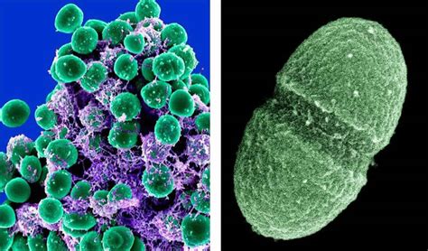 Enterococcus faecalis bacteria, infection & treatment