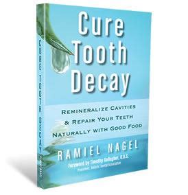 Book - Cure Tooth Decay, by Ramiel Nagel – Healthy Traditions