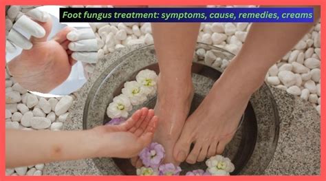 Foot fungus treatment: symptoms, cause, remedies, creams