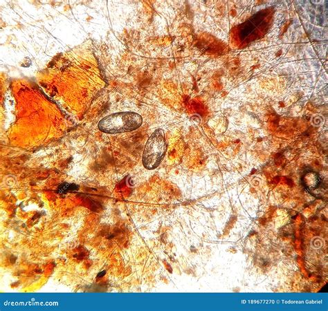 Ear Mite Eggs Under the Microscope Stock Photo - Image of parasitology, infection: 189677270